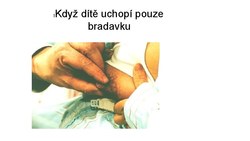 l Když dítě uchopí pouze bradavku 