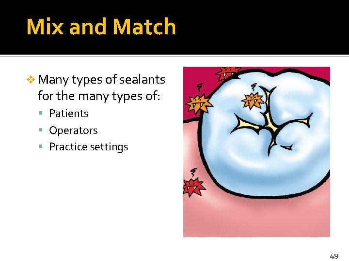Mix and Match v Many types of sealants for the many types of: Patients