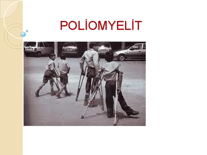 POLİOMYELİT 