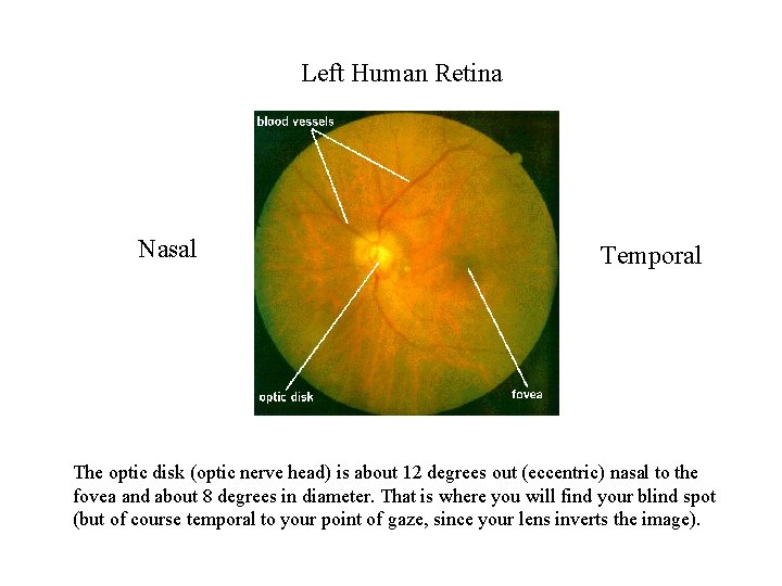 Left Human Retina Nasal Temporal The optic disk (optic nerve head) is about 12
