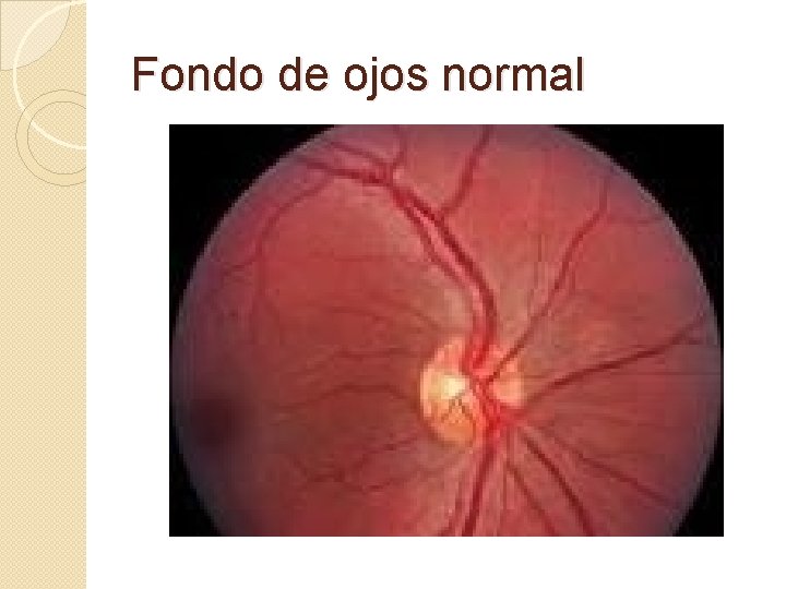 Fondo de ojos normal Fondo de ojos normal