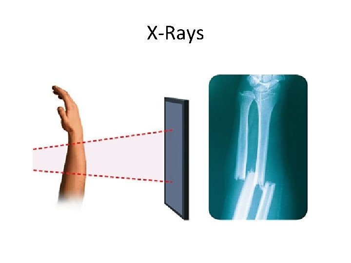 X-Rays 