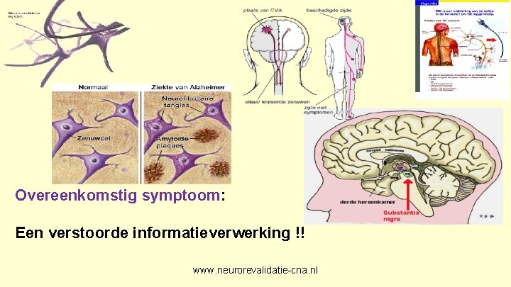 Overeenkomstig symptoom: Een verstoorde informatieverwerking !! www. neurorevalidatie-cna. nl 