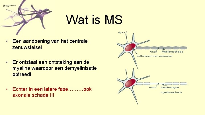 Wat is MS • Een aandoening van het centrale zenuwstelsel • Er ontstaat een