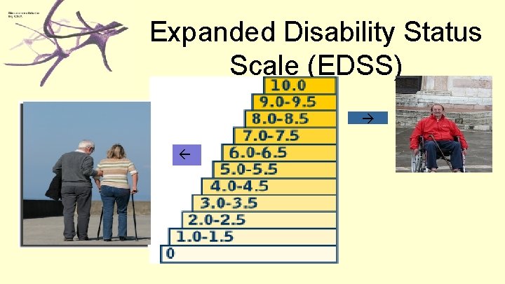 Expanded Disability Status Scale (EDSS) 