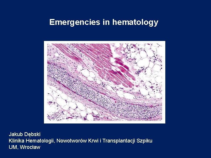 Emergencies in hematology Jakub Dębski Klinika Hematologii, Nowotworów Krwi i Transplantacji Szpiku UM, Wrocław