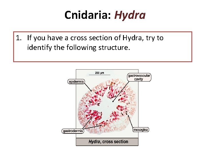 Cnidaria: Hydra 1. If you have a cross section of Hydra, try to identify Cnidaria: Hydra 1. If you have a cross section of Hydra, try to identify