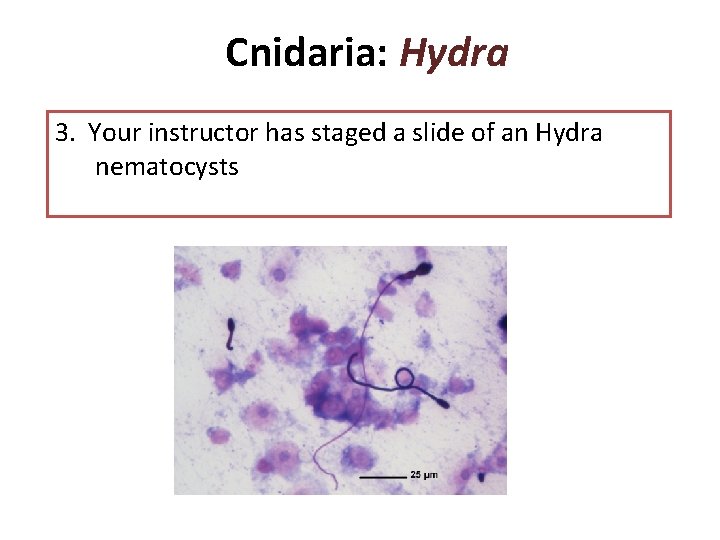 Cnidaria: Hydra 3. Your instructor has staged a slide of an Hydra nematocysts 