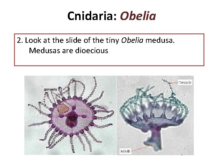 Cnidaria: Obelia 2. Look at the slide of the tiny Obelia medusa. Medusas are