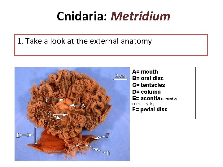 Cnidaria: Metridium 1. Take a look at the external anatomy A= mouth B= oral