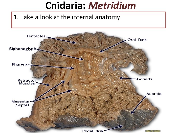 Cnidaria: Metridium 1. Take a look at the internal anatomy Cnidaria: Metridium 1. Take a look at the internal anatomy