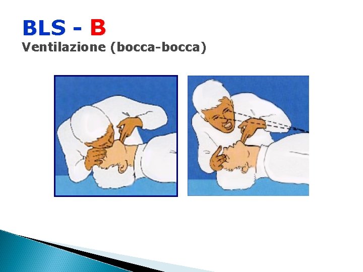BLS - B Ventilazione (bocca-bocca) 