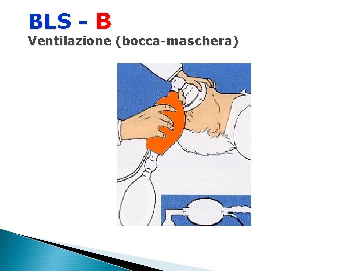BLS - B Ventilazione (bocca-maschera) 