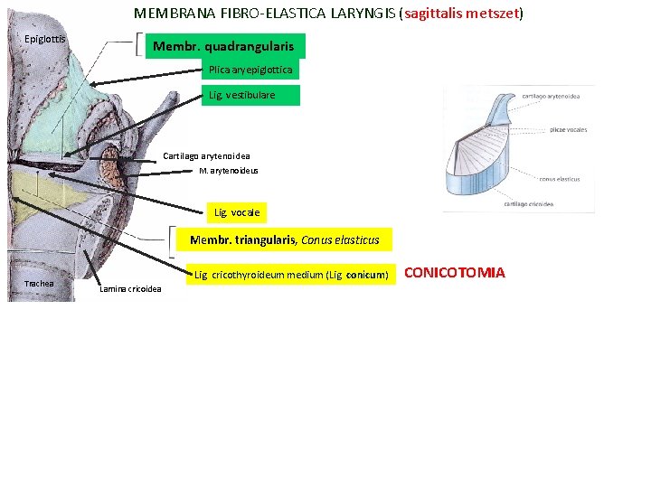 MEMBRANA FIBRO-ELASTICA LARYNGIS (sagittalis metszet) Epiglottis Membr. quadrangularis Plica aryepiglottica Lig. vestibulare Cartilago arytenoidea MEMBRANA FIBRO-ELASTICA LARYNGIS (sagittalis metszet) Epiglottis Membr. quadrangularis Plica aryepiglottica Lig. vestibulare Cartilago arytenoidea