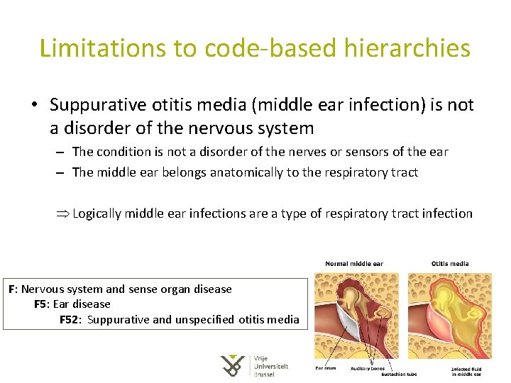 Limitations to code-based hierarchies • Suppurative otitis media (middle ear infection) is not a Limitations to code-based hierarchies • Suppurative otitis media (middle ear infection) is not a