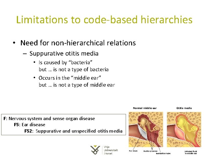 Limitations to code-based hierarchies • Need for non-hierarchical relations – Suppurative otitis media • Limitations to code-based hierarchies • Need for non-hierarchical relations – Suppurative otitis media •