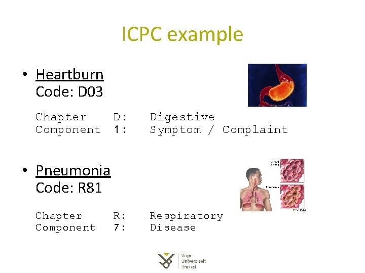 ICPC example • Heartburn Code: D 03 Chapter D: Component 1: Digestive Symptom / ICPC example • Heartburn Code: D 03 Chapter D: Component 1: Digestive Symptom /