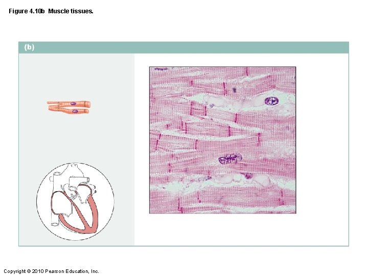 Figure 4. 10 b Muscle tissues. Copyright © 2010 Pearson Education, Inc. 
