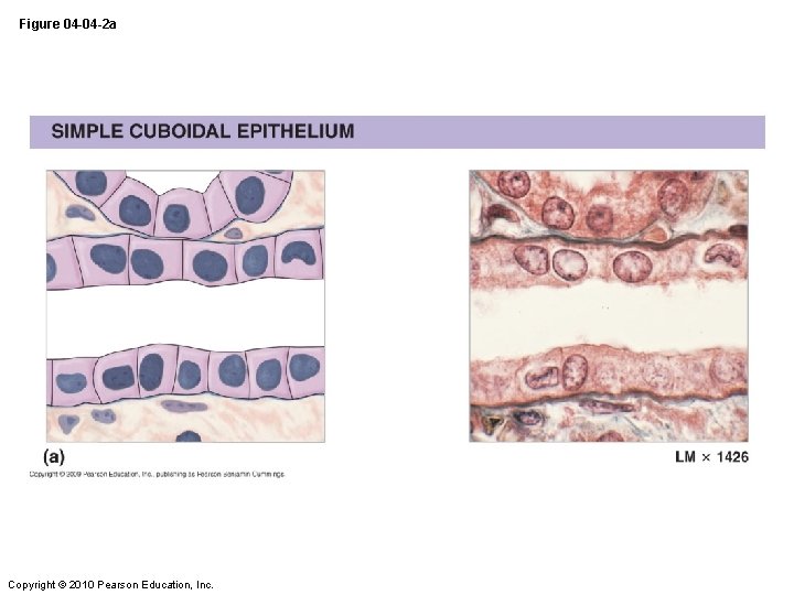 Figure 04 -04 -2 a Copyright © 2010 Pearson Education, Inc. 