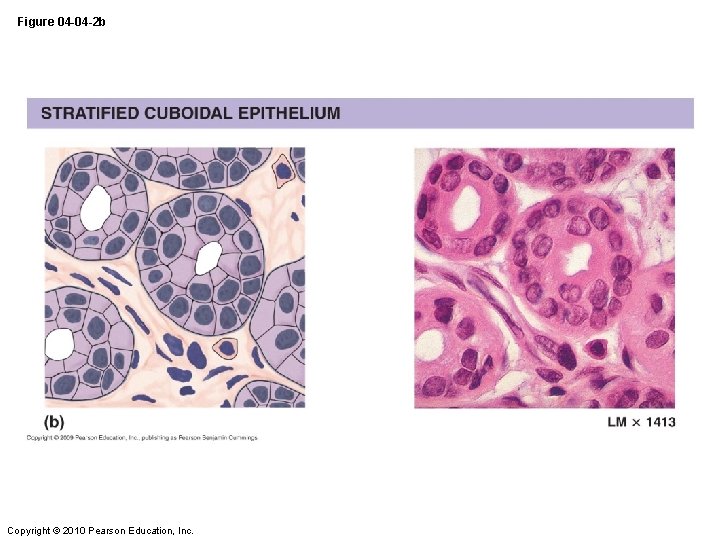 Figure 04 -04 -2 b Copyright © 2010 Pearson Education, Inc. 