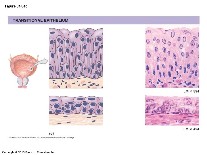 Figure 04 -04 c Copyright © 2010 Pearson Education, Inc. 