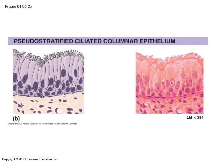 Figure 04 -05 -2 b Copyright © 2010 Pearson Education, Inc. 