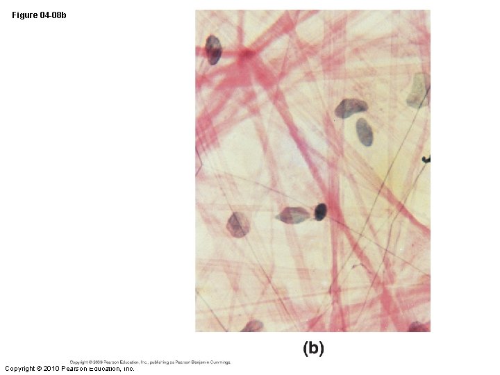 Figure 04 -08 b Copyright © 2010 Pearson Education, Inc. 