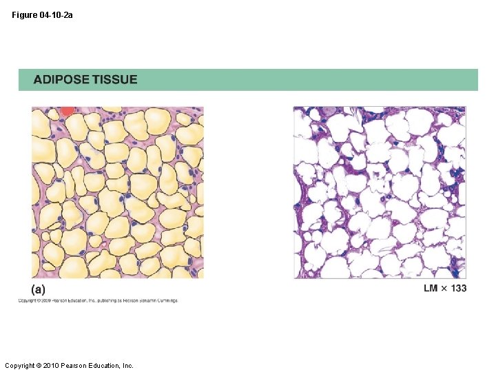 Figure 04 -10 -2 a Copyright © 2010 Pearson Education, Inc. 