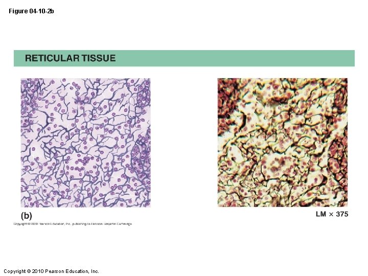 Figure 04 -10 -2 b Copyright © 2010 Pearson Education, Inc. 