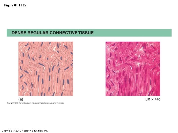 Figure 04 -11 -2 a Copyright © 2010 Pearson Education, Inc. 
