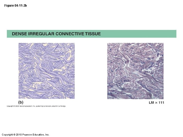 Figure 04 -11 -2 b Copyright © 2010 Pearson Education, Inc. 