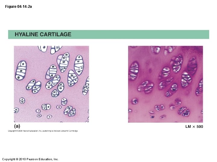 Figure 04 -14 -2 a Copyright © 2010 Pearson Education, Inc. 