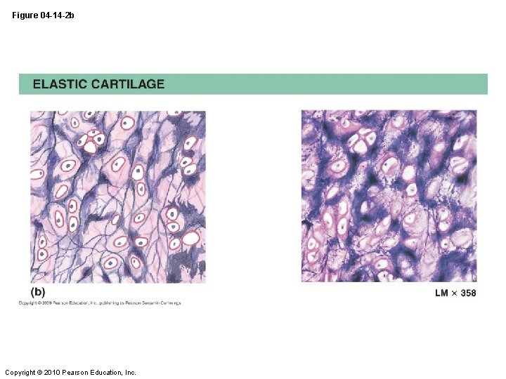 Figure 04 -14 -2 b Copyright © 2010 Pearson Education, Inc. 