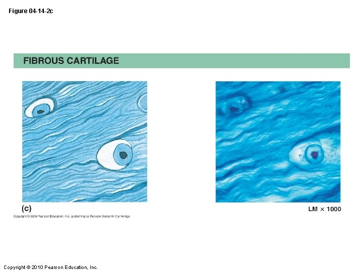 Figure 04 -14 -2 c Copyright © 2010 Pearson Education, Inc. 