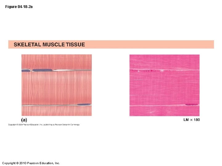 Figure 04 -18 -2 a Copyright © 2010 Pearson Education, Inc. 