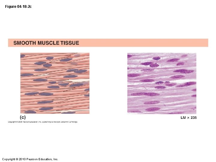 Figure 04 -18 -2 c Copyright © 2010 Pearson Education, Inc. 