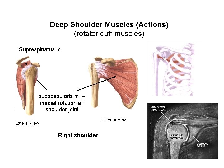 Deep Shoulder Muscles (Actions) (rotator cuff muscles) Supraspinatus m. subscapularis m. – medial rotation