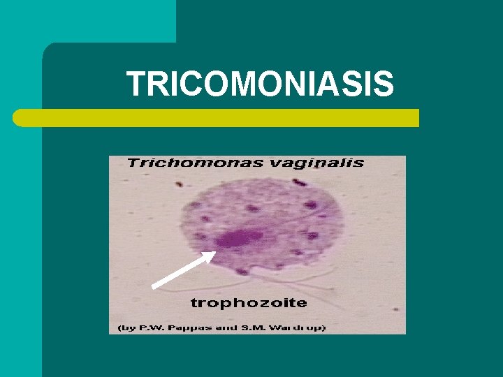 TRICOMONIASIS 