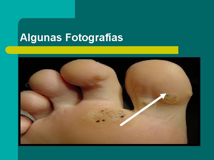 Algunas Fotografías 