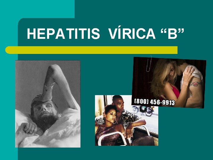 HEPATITIS VÍRICA “B” 