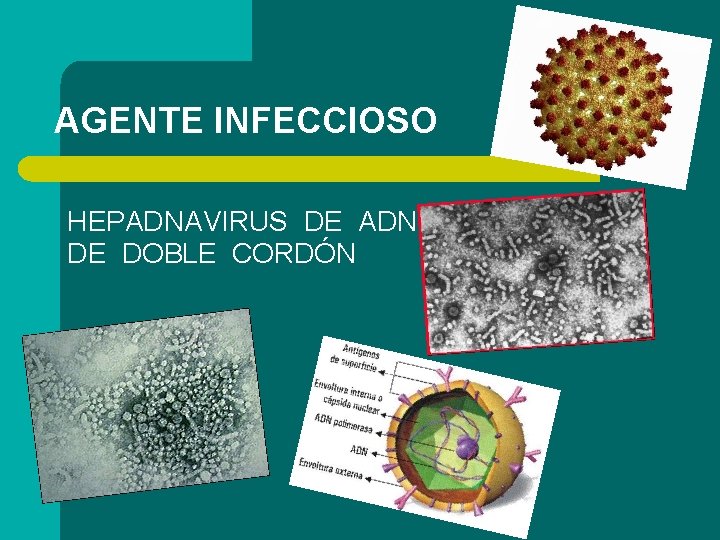 AGENTE INFECCIOSO HEPADNAVIRUS DE ADN DE DOBLE CORDÓN 