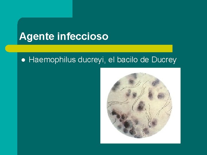 Agente infeccioso l Haemophilus ducreyi, el bacilo de Ducrey 