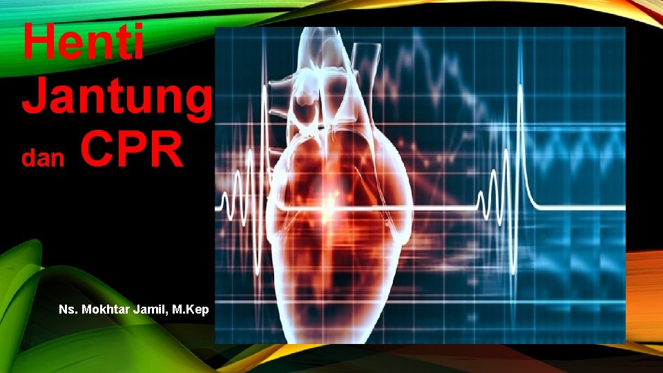 Henti Jantung dan CPR Ns. Mokhtar Jamil, M. Kep 