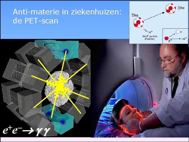 Anti-materie in ziekenhuizen: de PET-scan + ee 