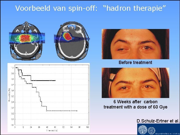 Voorbeeld van spin-off: “hadron therapie” Before treatment 6 Weeks after carbon treatment with a