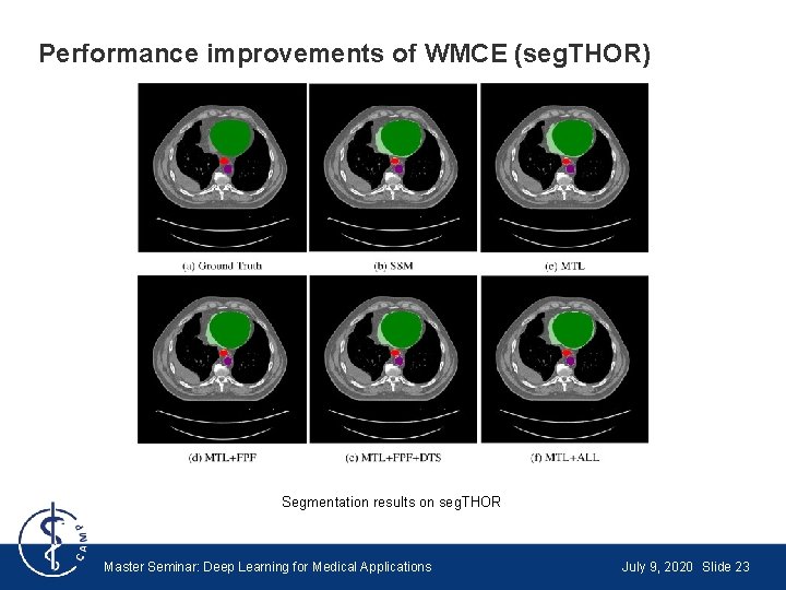Performance improvements of WMCE (seg. THOR) Segmentation results on seg. THOR Master Seminar: Deep