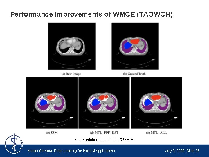 Performance improvements of WMCE (TAOWCH) Segmentation results on TAWOCH Master Seminar: Deep Learning for