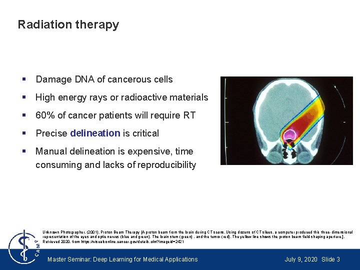 Radiation therapy § Damage DNA of cancerous cells § High energy rays or radioactive