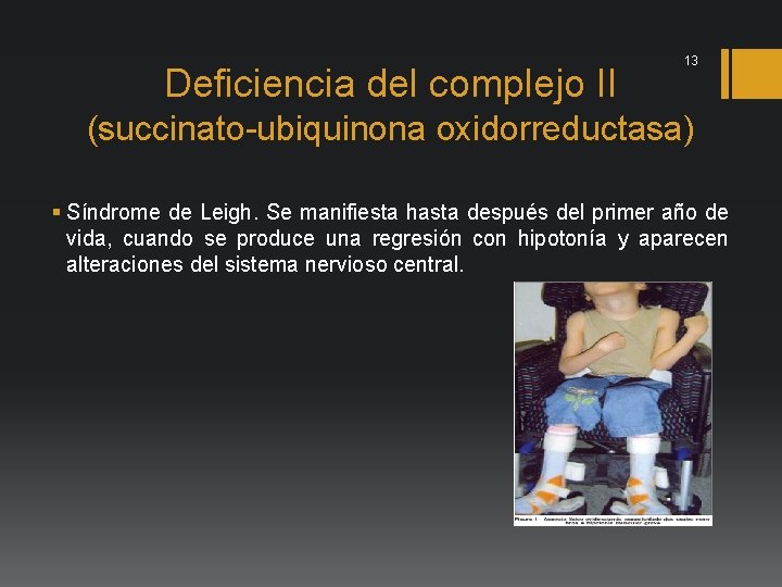 Deficiencia del complejo II 13 (succinato-ubiquinona oxidorreductasa) § Síndrome de Leigh. Se manifiesta hasta