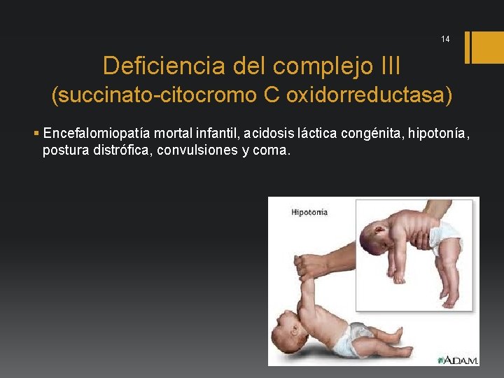 14 Deficiencia del complejo III (succinato-citocromo C oxidorreductasa) § Encefalomiopatía mortal infantil, acidosis láctica